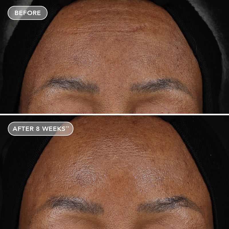 Ageless+ Retinol treatment crème 1.2% retinol complex