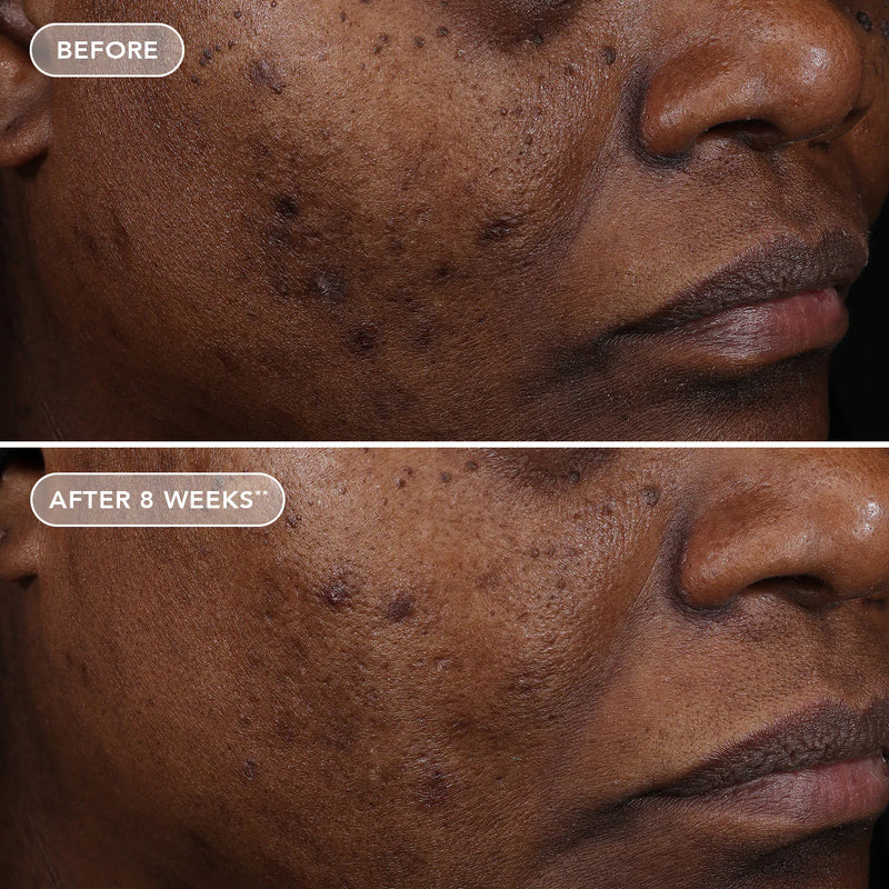 Ageless+ Retinol treatment crème 1.2% retinol complex