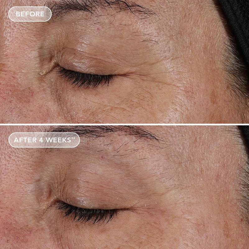 Ageless+ Retinol pure liquid retinol 0.1%