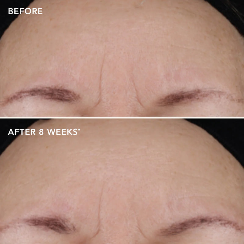 Ageless+ Retinol treatment crème 1.2% retinol complex