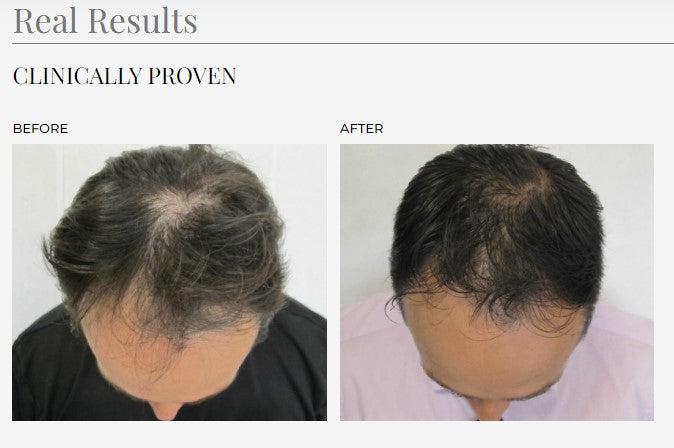 KIT RIPRISTINO BELLEZZA CAPELLI